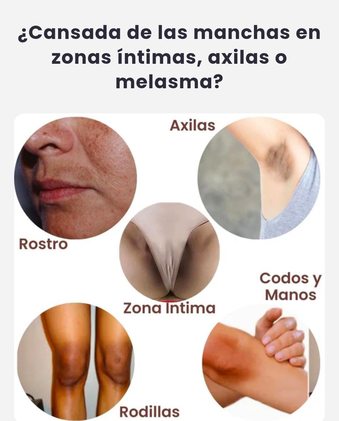 🌸CREMA MISKINNE✨ Aclara manchas, unifica el tono y realza tu belleza natural..🏵️
